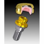 Rhein83 Low-Profile Lock Attachment 50 degree angle OT Smartbox Housing Cap Accessories - Image 2